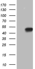 HOXC4 Antibody in Western Blot (WB)