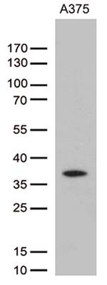 HOXD8 Antibody in Western Blot (WB)