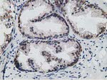 HPGD Antibody in Immunohistochemistry (Paraffin) (IHC (P))