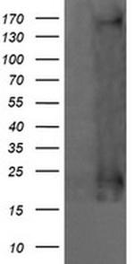 HRAS Antibody in Western Blot (WB)