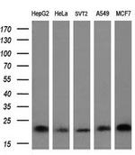 HRAS Antibody in Western Blot (WB)