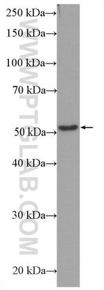 Beta Tubulin Antibody in Western Blot (WB)