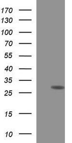 HSCB Antibody in Western Blot (WB)