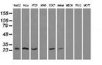 HSD17B10 Antibody in Western Blot (WB)