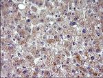 HSD17B4 Antibody in Immunohistochemistry (Paraffin) (IHC (P))