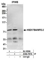 HSD17B4/MFE-2/17-beta-HSD4 Antibody in Immunoprecipitation (IP)
