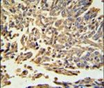 HSP27 Antibody in Immunohistochemistry (IHC)