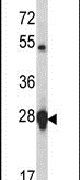 HSP27 Antibody in Western Blot (WB)