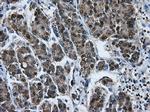 HSPA1A Antibody in Immunohistochemistry (Paraffin) (IHC (P))