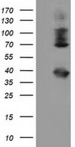 HSPA6 Antibody in Western Blot (WB)