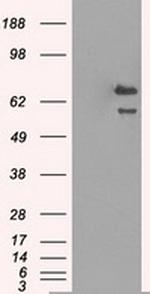 HSPA9 Antibody in Western Blot (WB)