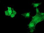 HSPB7 Antibody in Immunocytochemistry (ICC/IF)