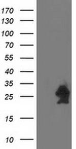HSPB7 Antibody in Western Blot (WB)