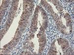 HSPBP1 Antibody in Immunohistochemistry (Paraffin) (IHC (P))