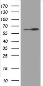 Hsp60 (HSPD1) Antibody in Western Blot (WB)