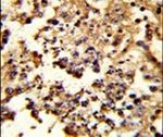 HSP105 Antibody in Immunohistochemistry (IHC)