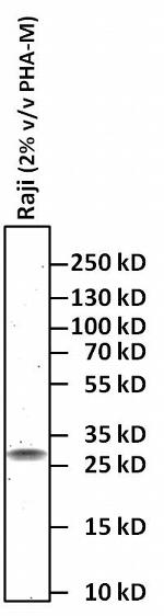 Syrian Hamster IgG (H+L) Secondary Antibody in Western Blot (WB)