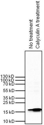 H3K9me2S10phK27me2S28ph Antibody in Western Blot (WB)