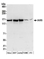 IARS Antibody in Western Blot (WB)