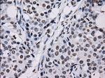 ID3 Antibody in Immunohistochemistry (Paraffin) (IHC (P))