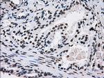 ID3 Antibody in Immunohistochemistry (Paraffin) (IHC (P))