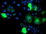 IDS Antibody in Immunocytochemistry (ICC/IF)