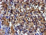 IDS Antibody in Immunohistochemistry (Paraffin) (IHC (P))