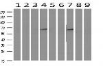 IDS Antibody in Western Blot (WB)