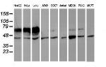 IDS Antibody in Western Blot (WB)