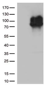 IFNLR1 Antibody in Western Blot (WB)