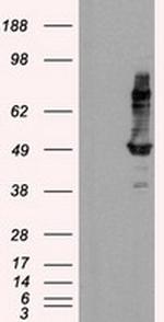 IFT57 Antibody in Western Blot (WB)