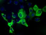 IGF2BP2 Antibody in Immunocytochemistry (ICC/IF)