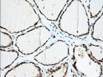 IGF2BP2 Antibody in Immunohistochemistry (Paraffin) (IHC (P))