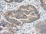 IGF2BP2 Antibody in Immunohistochemistry (Paraffin) (IHC (P))