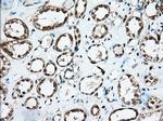 IGF2BP2 Antibody in Immunohistochemistry (Paraffin) (IHC (P))