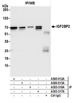 IGF2BP2 Antibody in Western Blot (WB)