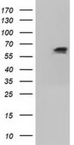 IGF2BP2 Antibody in Western Blot (WB)