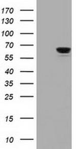 IGF2BP2 Antibody in Western Blot (WB)