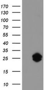 IGJ Antibody in Western Blot (WB)