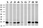 IGJ Antibody in Western Blot (WB)