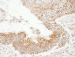 PDZ-GEF1 Antibody in Immunohistochemistry (IHC)