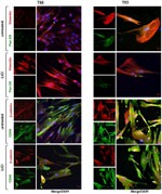 Cytokeratin Pan Antibody in Immunocytochemistry (ICC/IF)