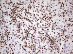 IKZF3 Antibody in Immunohistochemistry (Paraffin) (IHC (P))