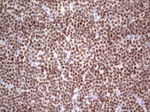 IKZF3 Antibody in Immunohistochemistry (Paraffin) (IHC (P))