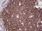 IKZF3 Antibody in Immunohistochemistry (Paraffin) (IHC (P))