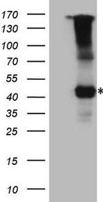 IL12RB1 Antibody in Western Blot (WB)