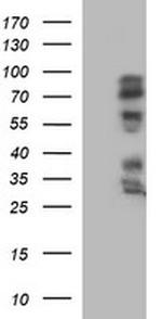 IL1A Antibody in Western Blot (WB)