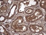 IL1RN Antibody in Immunohistochemistry (Paraffin) (IHC (P))