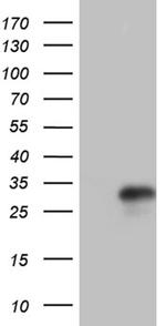 IL24 Antibody in Western Blot (WB)