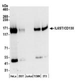 IL6ST/CD130 Antibody in Western Blot (WB)
